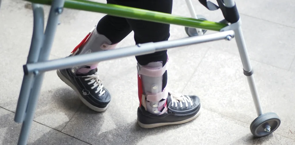 sepasang kaki yang memakai alat bantu berupa sepatu dan kruk