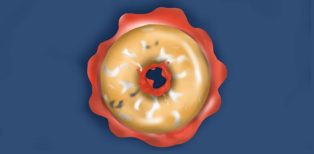 bagian atas dari donat yang berjamur