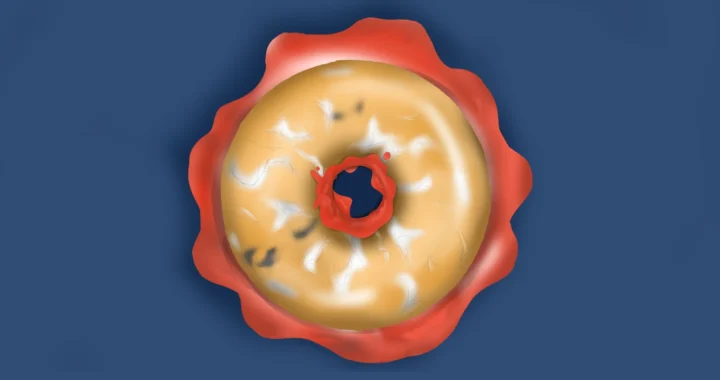 bagian atas dari donat yang berjamur