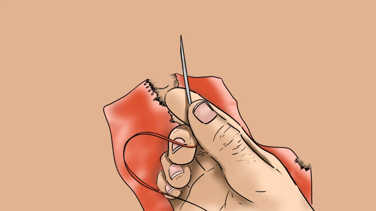 Ilustrasi tangan memegang jarum jahit dengan benang merah, sedang menjahit kain berwarna merah yang sobek