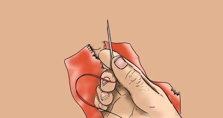 Ilustrasi tangan memegang jarum jahit dengan benang merah, sedang menjahit kain berwarna merah yang sobek