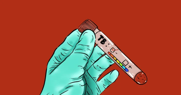 Tangan bersarung tangan medis memegang tabung tes TB dengan hasil negatif.